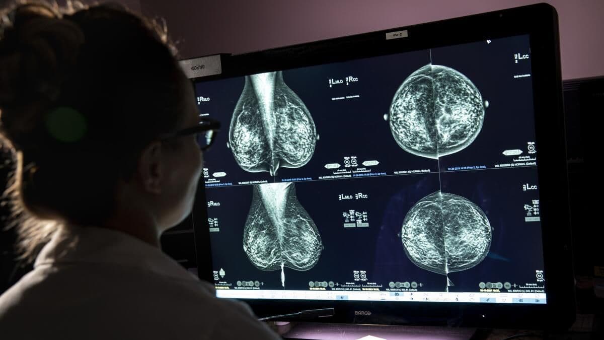 La Provincia adelantó la edad para la primera mamografía y en Pergamino habrá jornadas gratuitas de control