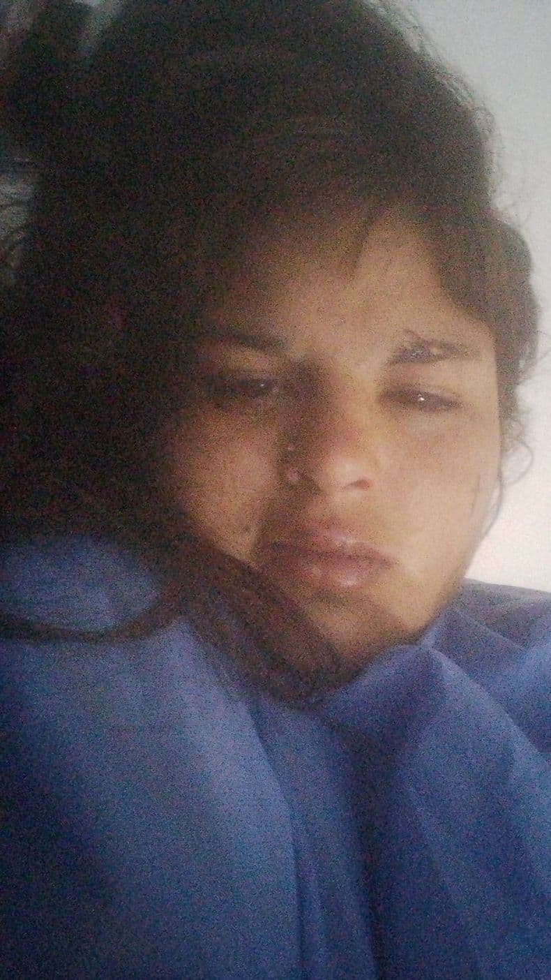 Una joven de 23 años sufrió una brutal agresión de su pareja en Pergamino