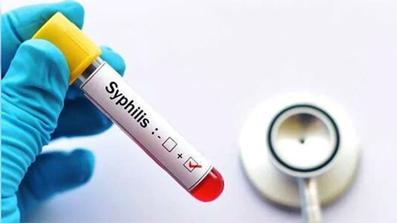 En Argentina se registraron más de 50 mil casos de sífilis en el año 2025