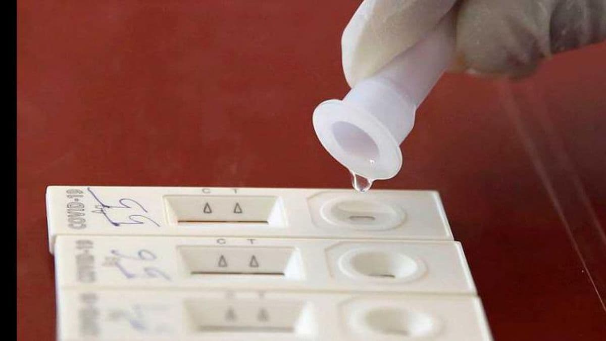 Dos personas fallecidas y 83 nuevos casos de Covid-19 en Pergamino