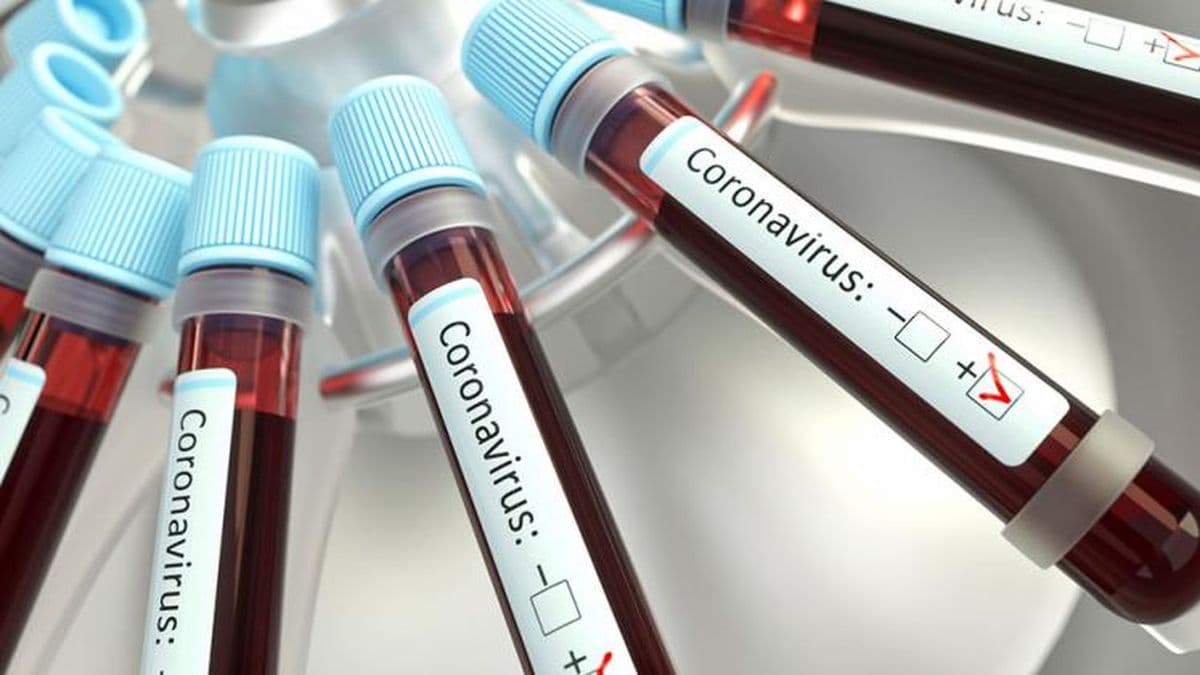 Informaron 56 nuevos casos de coronavirus en Pergamino