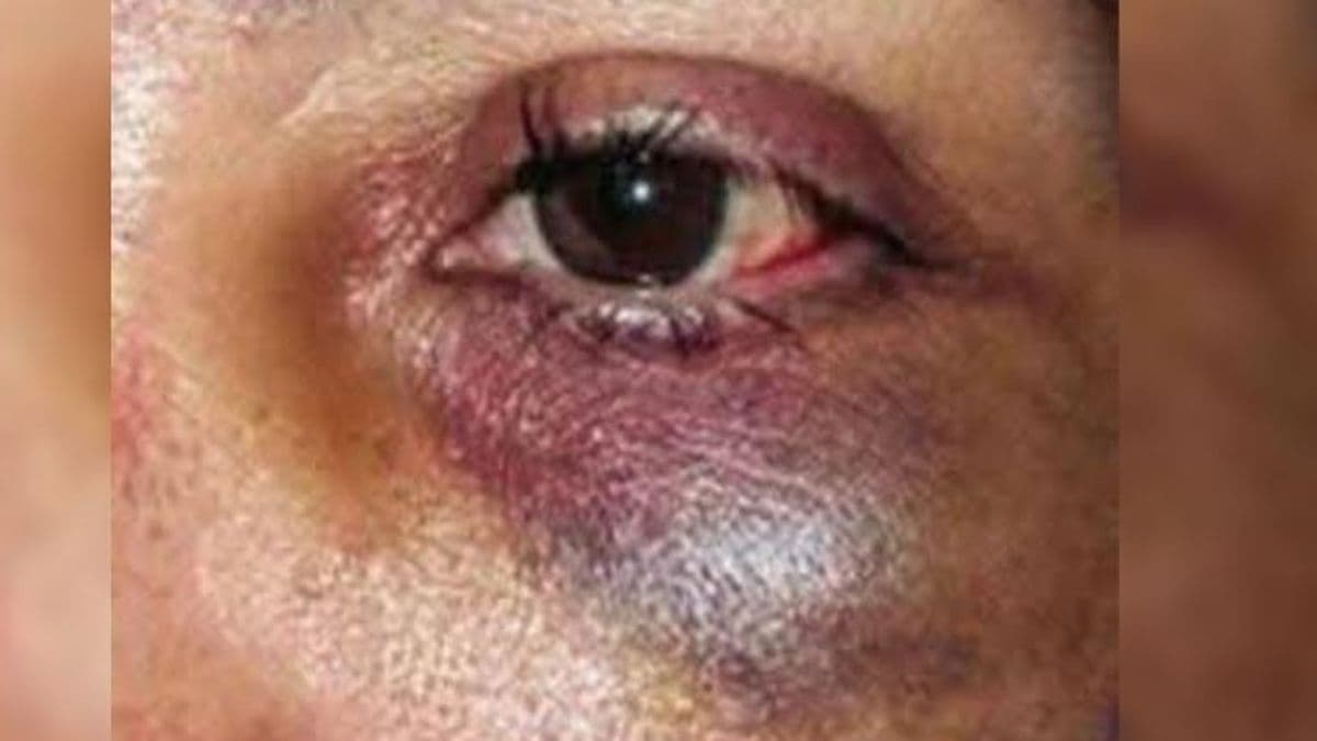 En Colón: una mujer adulta mayor denunció agresiones de un vecino