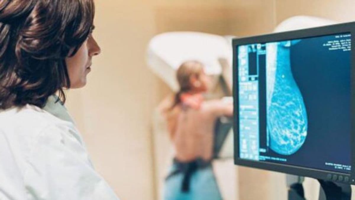 "La Noche de las Mamografías" este jueves en el Hospital San José