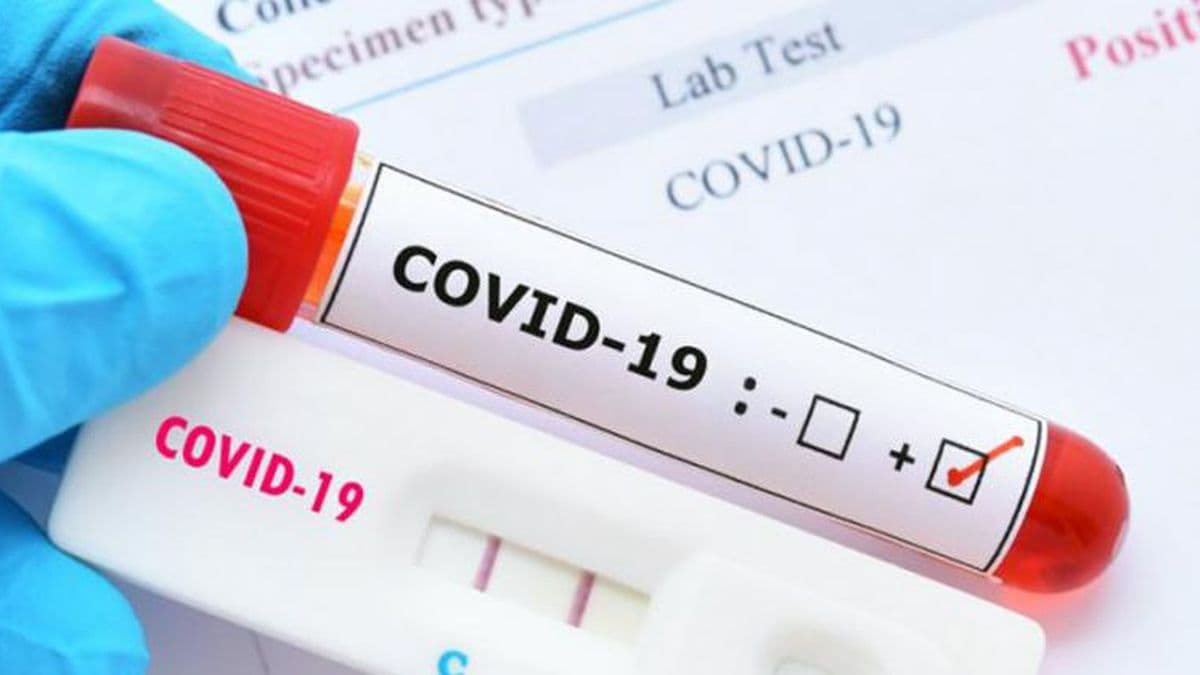 Covid: cinco nuevos casos se confirmaron este miércoles en Pergamino