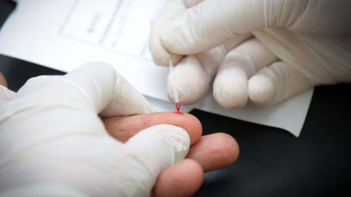 Testeos de VIH, Hepatitis C y Sífilis
