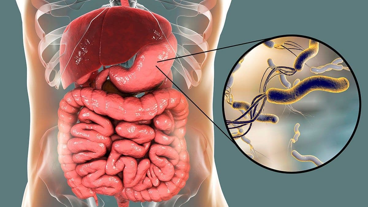 Helicobacter pylori: la bacteria silenciosa que afecta a casi la mitad de los argentinos
