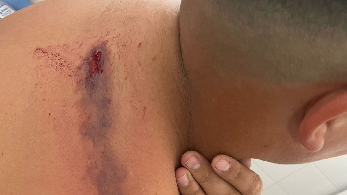 San Nicolás: niño de 11 años ingresado al Hospital San Felipe tras ser herido de bala en un ataque en moto