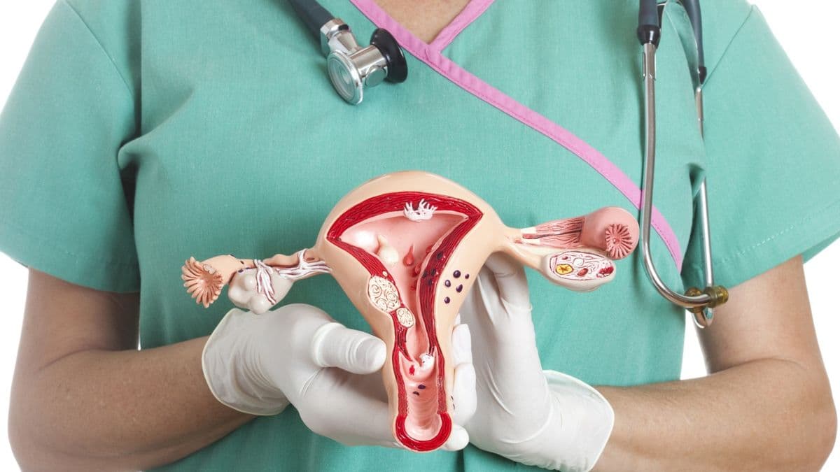 LALCEC San Pedro impulsa campaña gratuita de PAP para prevenir el cáncer de cuello de útero