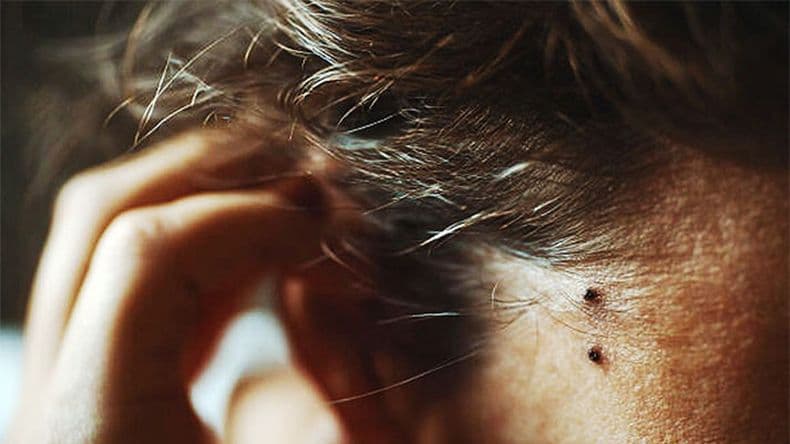 AlianzaMelaNOmás: el peluquero se suma a la campaña para concientizar sobre el melanoma