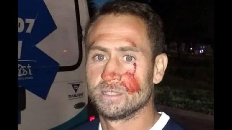 El “Bibi” González recibió una brutal agresión en un partido del Regional