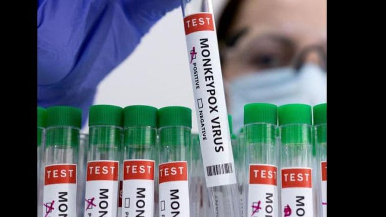 Viruela del mono: ¿en la antesala de otra pandemia?
