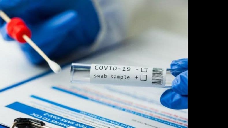 Los casos confirmados de Covid-19 serán determinados por laboratorio o por criterio clínico