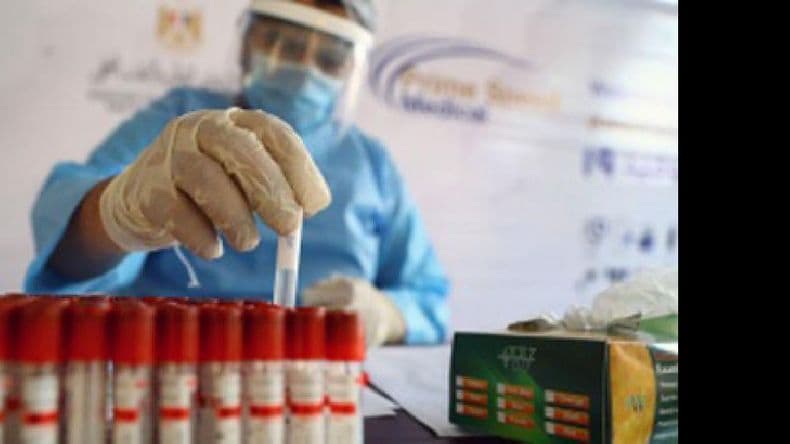 La Anmat aprobó el primer test argentino de diagnóstico basado en tecnología RT-PCR