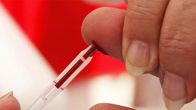 "Hacete el test. Sumá tu gotita", la campaña para promover el testeo de VIH