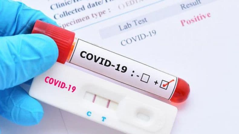 Coronavirus en Pergamino: un fallecimiento y 16 nuevos casos