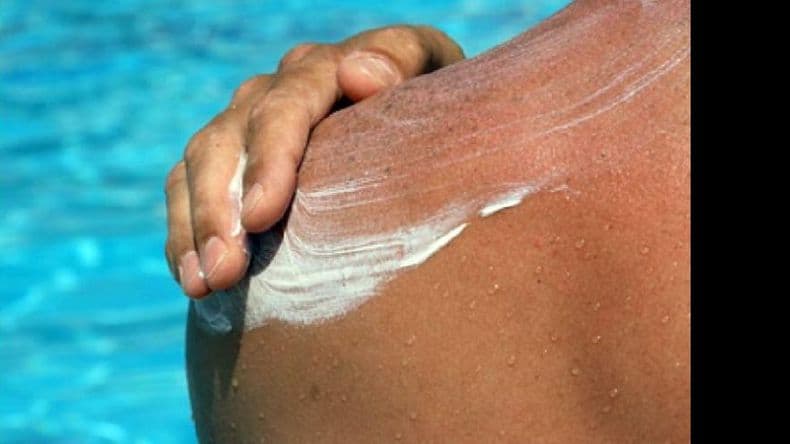 Cáncer de piel: consejos para cuidarse del sol