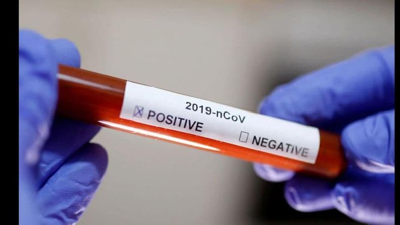 Confirmaron el primer caso de Coronavirus en Salto