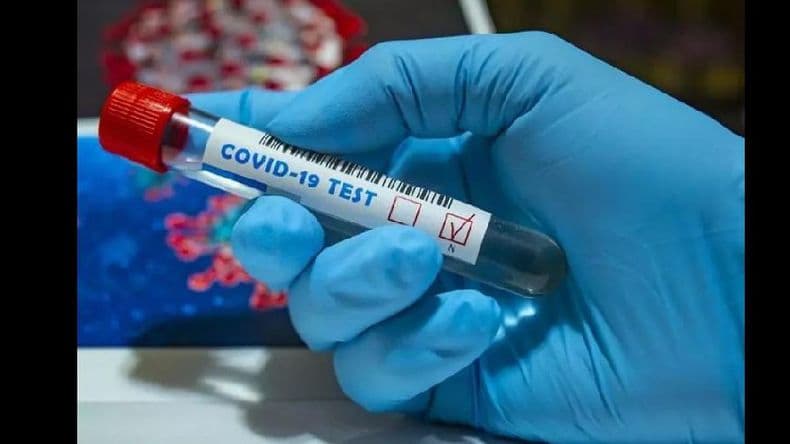 Este martes informaron 18 nuevos casos positivos de Covid-19