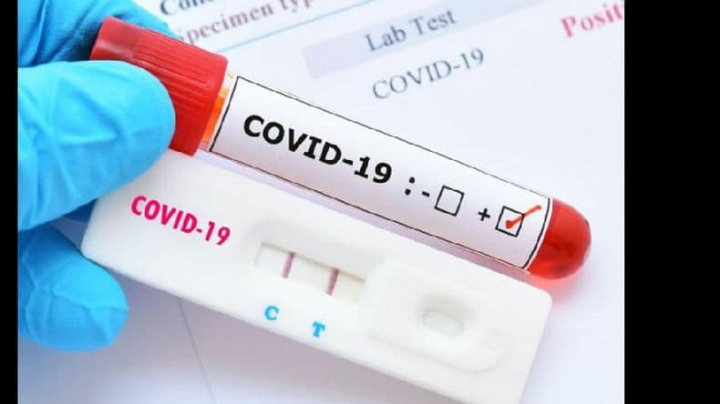 Coronavirus: falleció una mujer de 66 años y hay 27 nuevos casos positivos