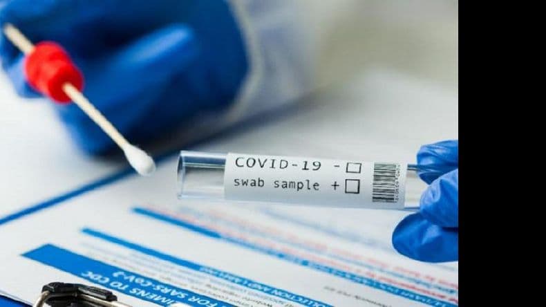 El parte de este domingo reportó 33 nuevos casos positivos de Covid-19 en Pergamino