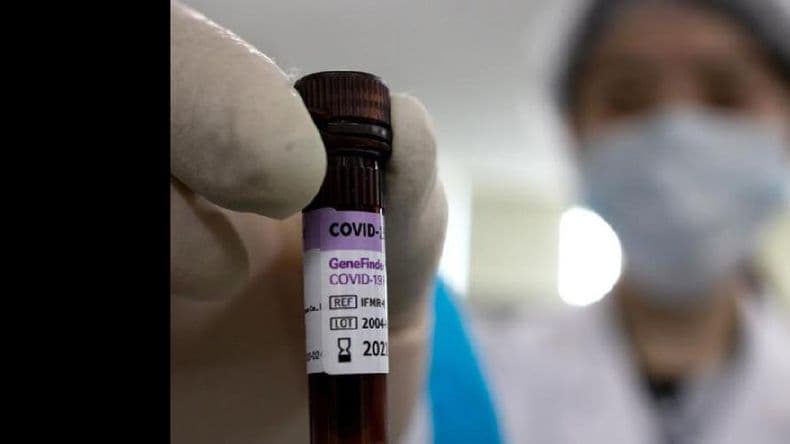 Este miércoles se reportaron 57 nuevos casos positivos de Covid-19 en Pergamino