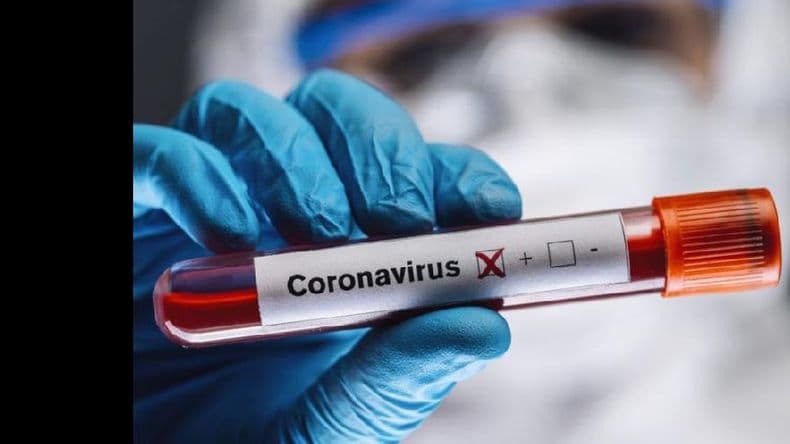 Confirmaron 25 nuevos casos de Covid-19 en Pergamino