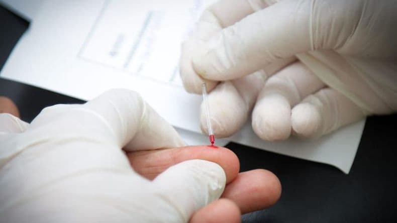 Este miércoles habrá testeos gratuitos de VIH