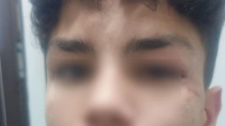 Violento ataque a un adolescente en pleno centro: buscan identificar al agresor