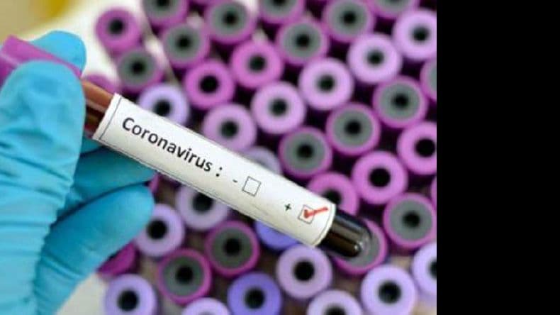Pergamino tiene 12 nuevos casos positivos de Covid-19