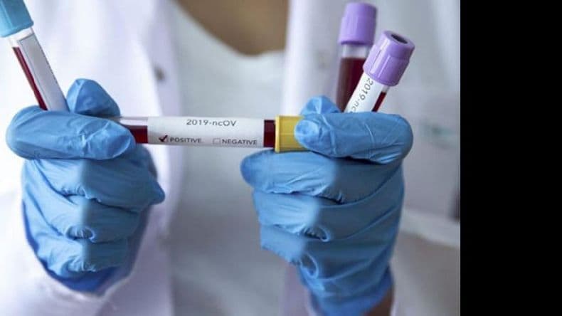 Este domingo se confirmaron 17 nuevos casos positivos