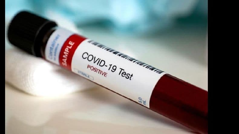 Covid-19: 48 nuevos casos positivos fueron reportados este sábado