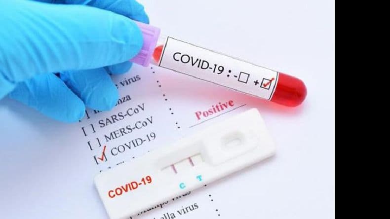 Pergamino: 12 nuevos casos positivos de Covid-19