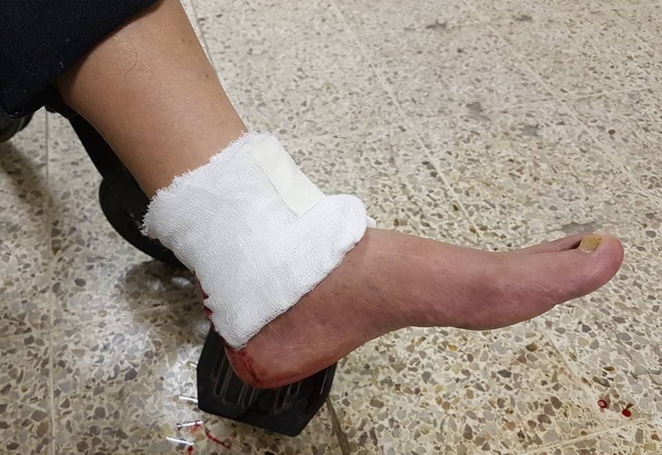 Balearon a un joven que no quiso denunciar a su atacante